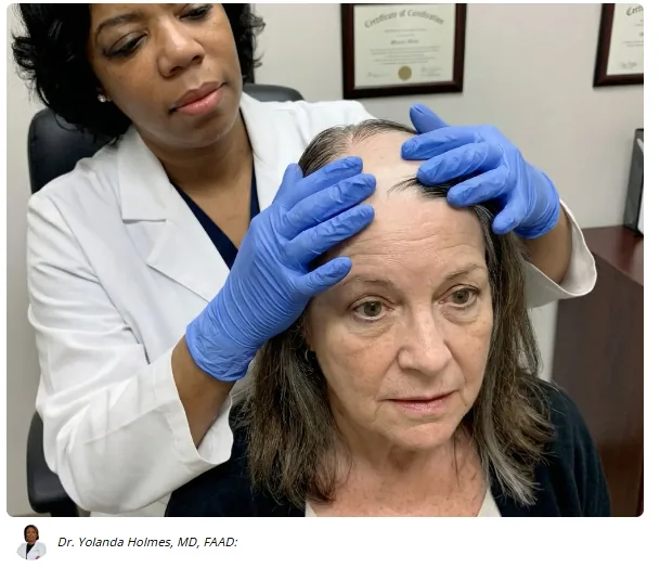 Dermatologist examining a woman's scalp